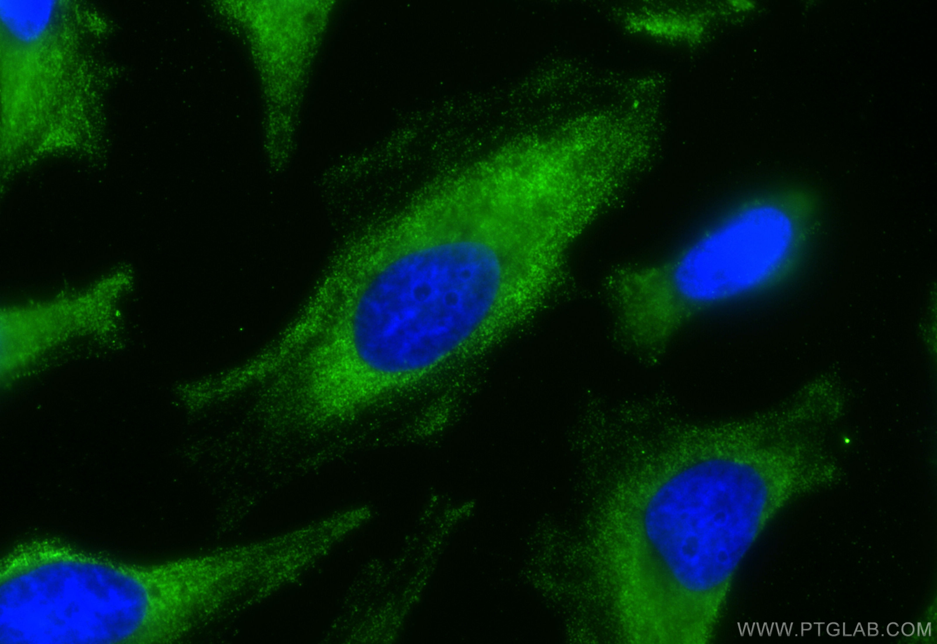 Immunofluorescence (IF) / fluorescent staining of HeLa cells using CoraLite® Plus 488-conjugated PFKP Monoclonal anti (CL488-68129)