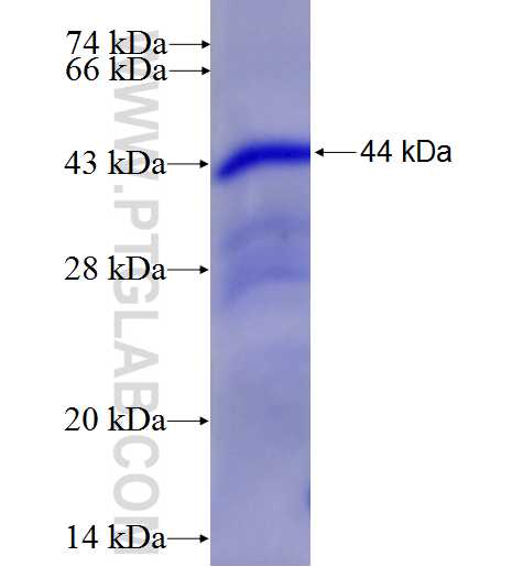 PFKP fusion protein Ag25206 SDS-PAGE