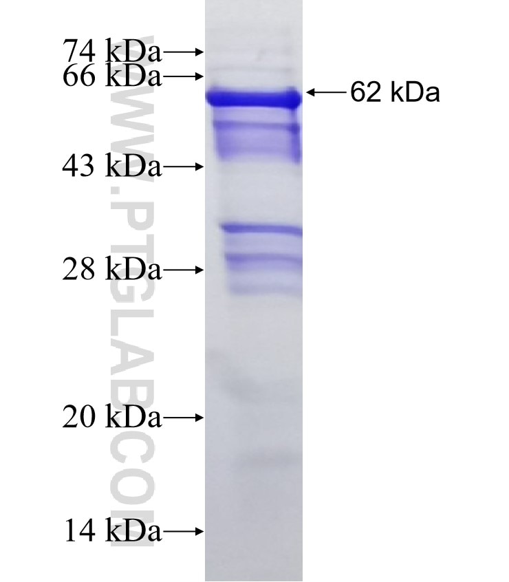 PFKP fusion protein Ag4047 SDS-PAGE