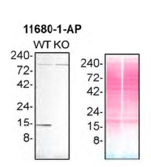 Western Blot (WB) analysis of HAP1 using Profilin 1 Polyclonal antibody (11680-1-AP)