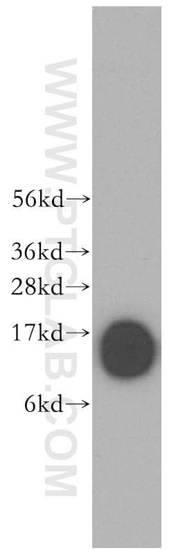 Western Blot (WB) analysis of Jurkat cells using Profilin 1 Polyclonal antibody (11680-1-AP)