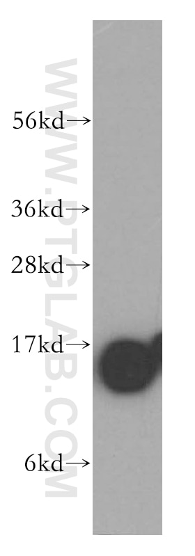 Western Blot (WB) analysis of HeLa cells using Profilin 1 Polyclonal antibody (11680-1-AP)