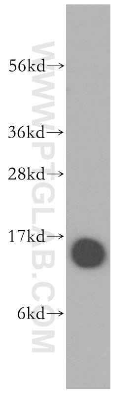 Profilin 1 Polyclonal antibody