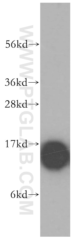 Western Blot (WB) analysis of NIH/3T3 cells using Profilin 1 Polyclonal antibody (11680-1-AP)