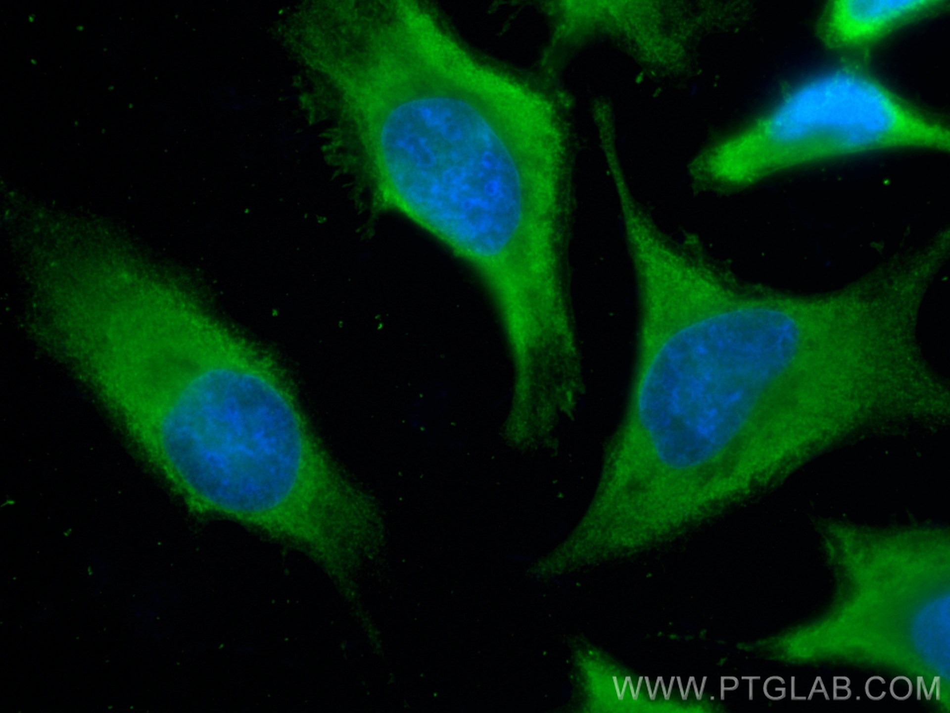 Immunofluorescence (IF) / fluorescent staining of HeLa cells using Profilin 1 Monoclonal antibody (67390-1-Ig)
