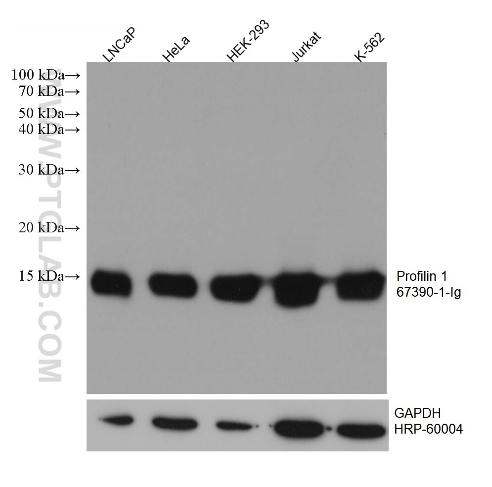 Western Blot (WB) analysis of various lysates using Profilin 1 Monoclonal antibody (67390-1-Ig)