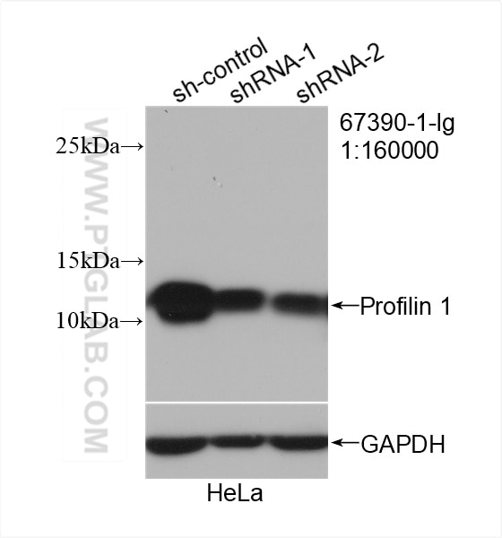 Western Blot (WB) analysis of HeLa cells using Profilin 1 Monoclonal antibody (67390-1-Ig)