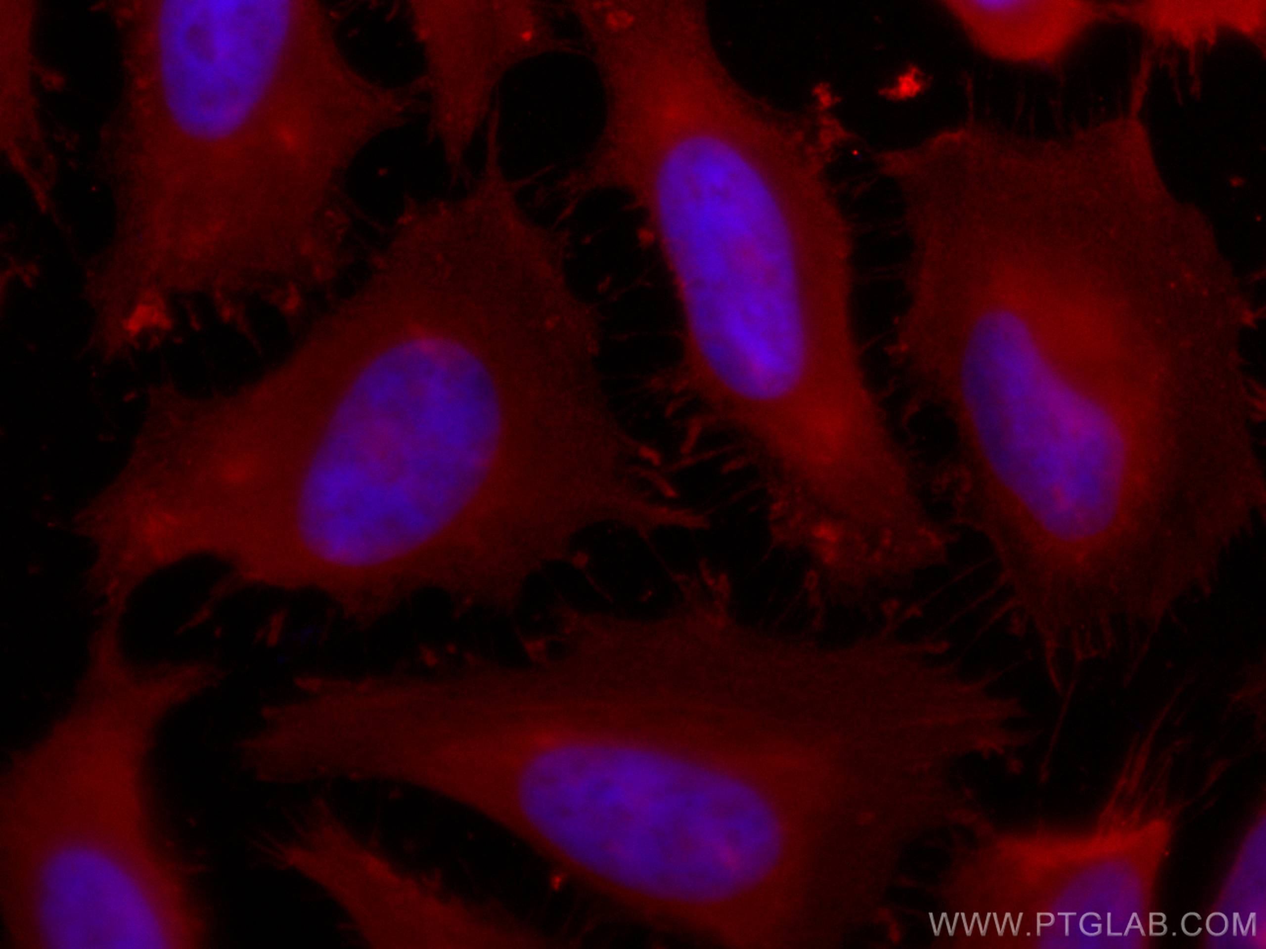 Immunofluorescence (IF) / fluorescent staining of HeLa cells using CoraLite®594-conjugated Profilin 1 Monoclonal anti (CL594-67390)