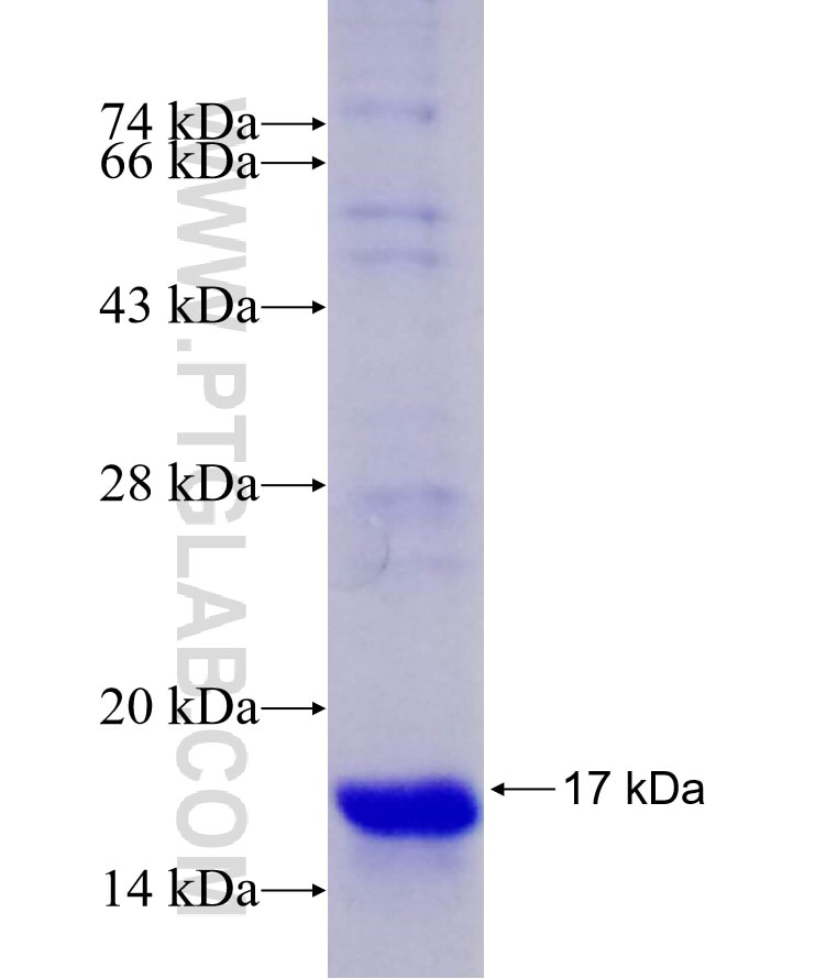 PFN1 fusion protein Ag29206 SDS-PAGE