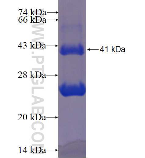 PFN1 fusion protein Ag2286 SDS-PAGE