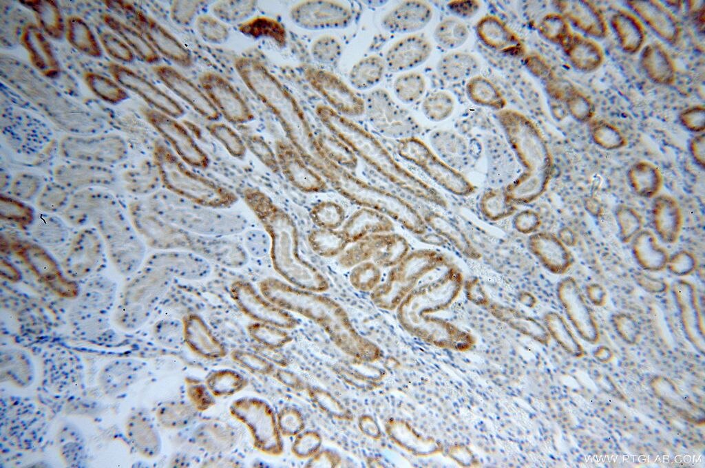 Immunohistochemistry (IHC) staining of human kidney tissue using PFN2 Monoclonal antibody (60094-1-Ig)