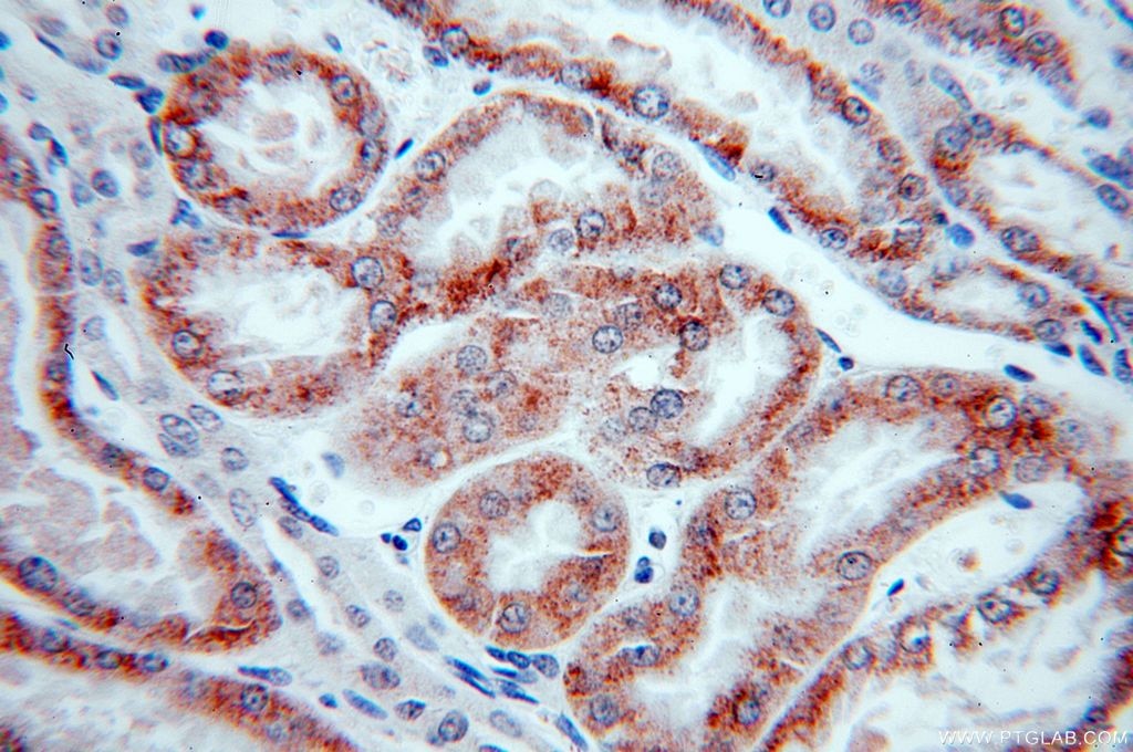 Immunohistochemistry (IHC) staining of human kidney tissue using PFN2 Monoclonal antibody (60094-1-Ig)