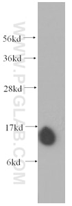 Western Blot (WB) analysis of human brain tissue using PFN2 Monoclonal antibody (60094-1-Ig)