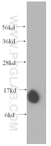 WB analysis of human brain using 60094-1-Ig