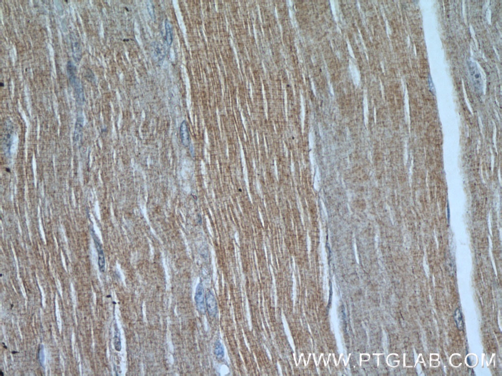 Immunohistochemistry (IHC) staining of human skeletal muscle tissue using PFN2 Monoclonal antibody (60094-2-Ig)