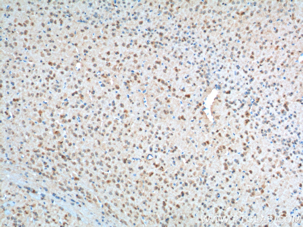 Immunohistochemistry (IHC) staining of mouse brain tissue using PFN2 Monoclonal antibody (60094-2-Ig)