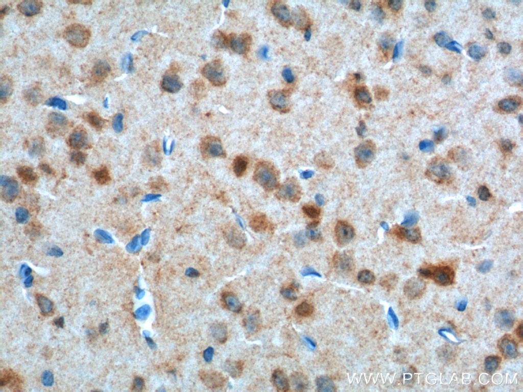 Immunohistochemistry (IHC) staining of mouse brain tissue using PFN2 Monoclonal antibody (60094-2-Ig)