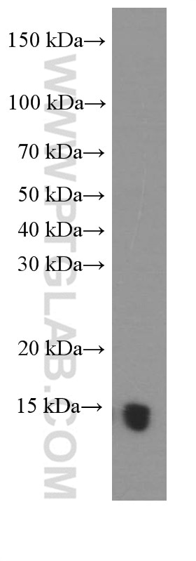 Western Blot (WB) analysis of mouse brain tissue using PFN2 Monoclonal antibody (60094-2-Ig)