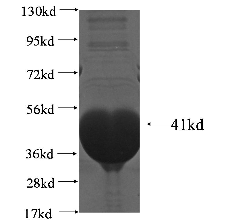 PFN2 fusion protein Ag4792 SDS-PAGE
