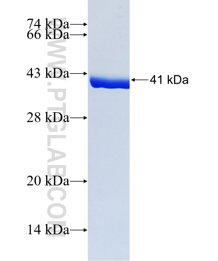 PFN2 fusion protein Ag4792 SDS-PAGE