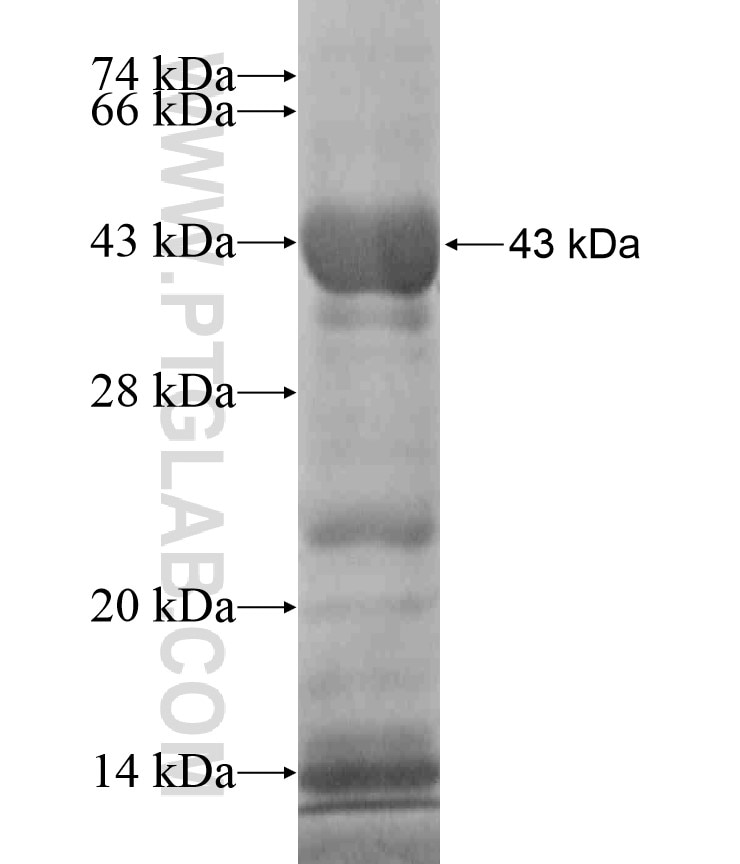 PFN3 fusion protein Ag18256 SDS-PAGE