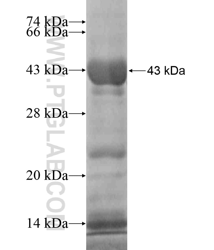 PFN3 fusion protein Ag18256 SDS-PAGE