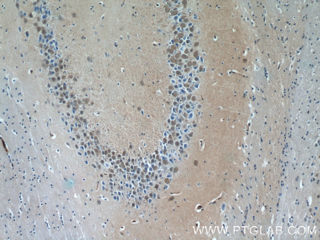 Immunohistochemistry (IHC) staining of mouse brain tissue using PFTK1 Polyclonal antibody (21612-1-AP)