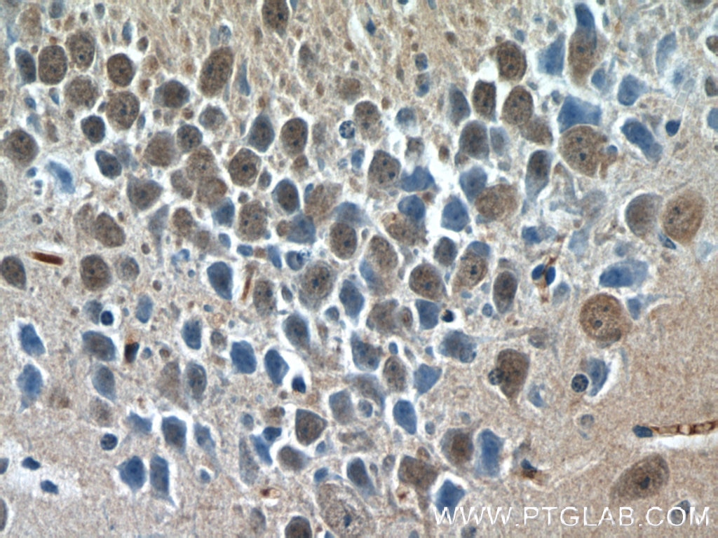 Immunohistochemistry (IHC) staining of mouse brain tissue using PFTK1 Polyclonal antibody (21612-1-AP)