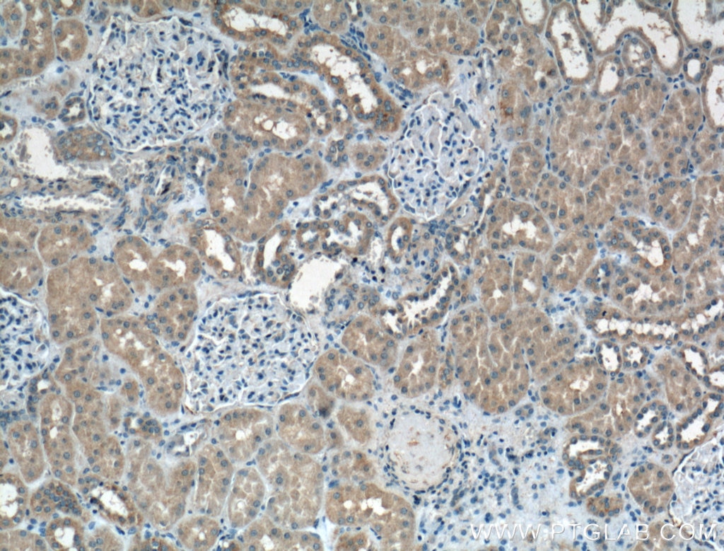 Immunohistochemistry (IHC) staining of human kidney tissue using PFTK1 Polyclonal antibody (21612-1-AP)