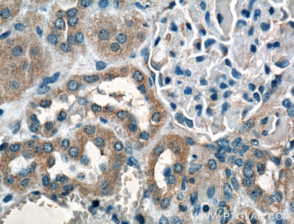 Immunohistochemistry (IHC) staining of human kidney tissue using PFTK1 Polyclonal antibody (21612-1-AP)