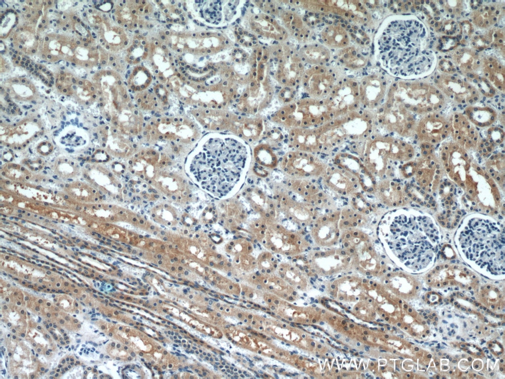 Immunohistochemistry (IHC) staining of human kidney tissue using PFTK1 Polyclonal antibody (21612-1-AP)