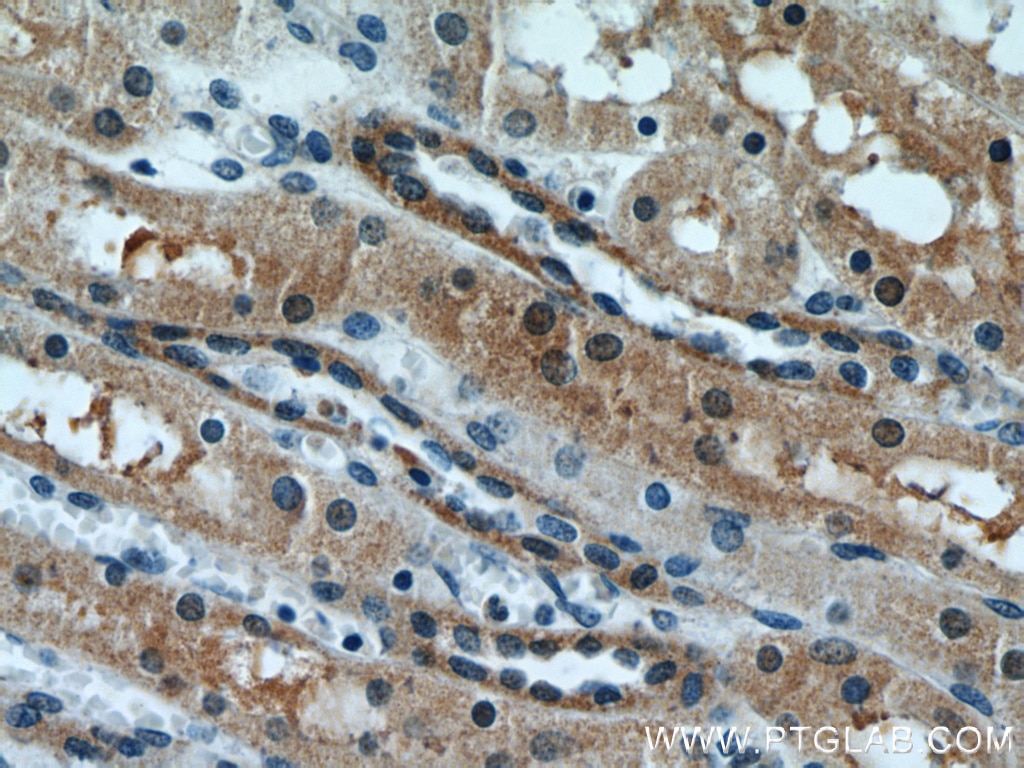 Immunohistochemistry (IHC) staining of human kidney tissue using PFTK1 Polyclonal antibody (21612-1-AP)