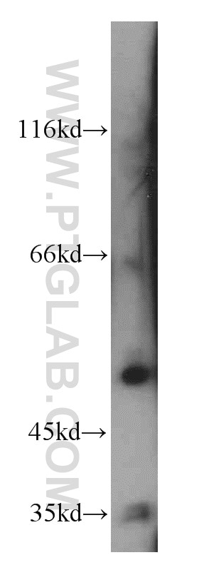 Western Blot (WB) analysis of mouse brain tissue using PFTK1 Polyclonal antibody (21612-1-AP)