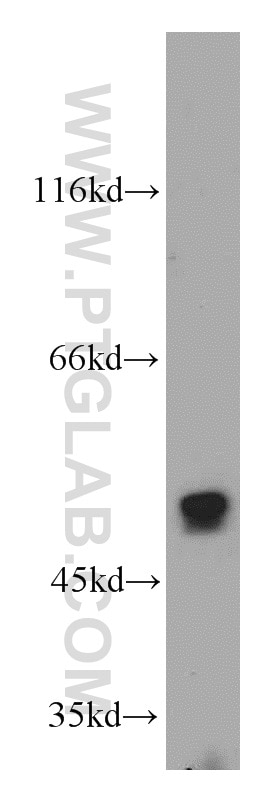Western Blot (WB) analysis of HeLa cells using PFTK1 Polyclonal antibody (21612-1-AP)