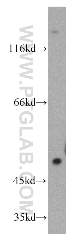 Western Blot (WB) analysis of SH-SY5Y cells using PFTK1 Polyclonal antibody (21612-1-AP)