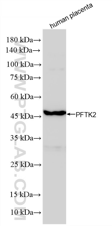 Western Blot (WB) analysis of various lysates using PFTK2 Recombinant monoclonal antibody (86397-1-RR)