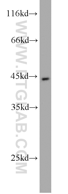Western Blot (WB) analysis of SGC-7901 cells using Pepsinogen I Polyclonal antibody (17330-1-AP)