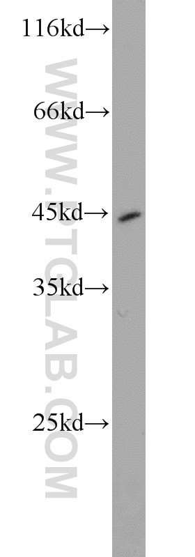 Western Blot (WB) analysis of SGC-7901 cells using Pepsinogen I Polyclonal antibody (17330-1-AP)