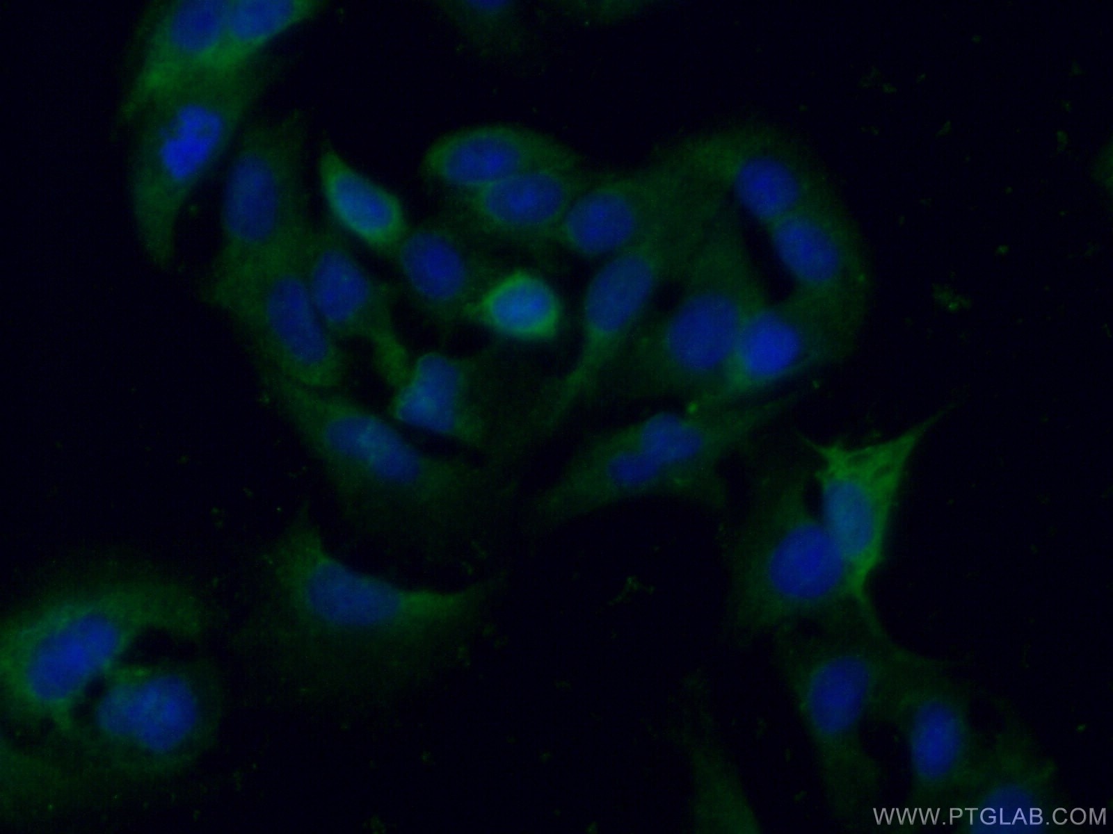 IF Staining of A549 using 16126-1-AP