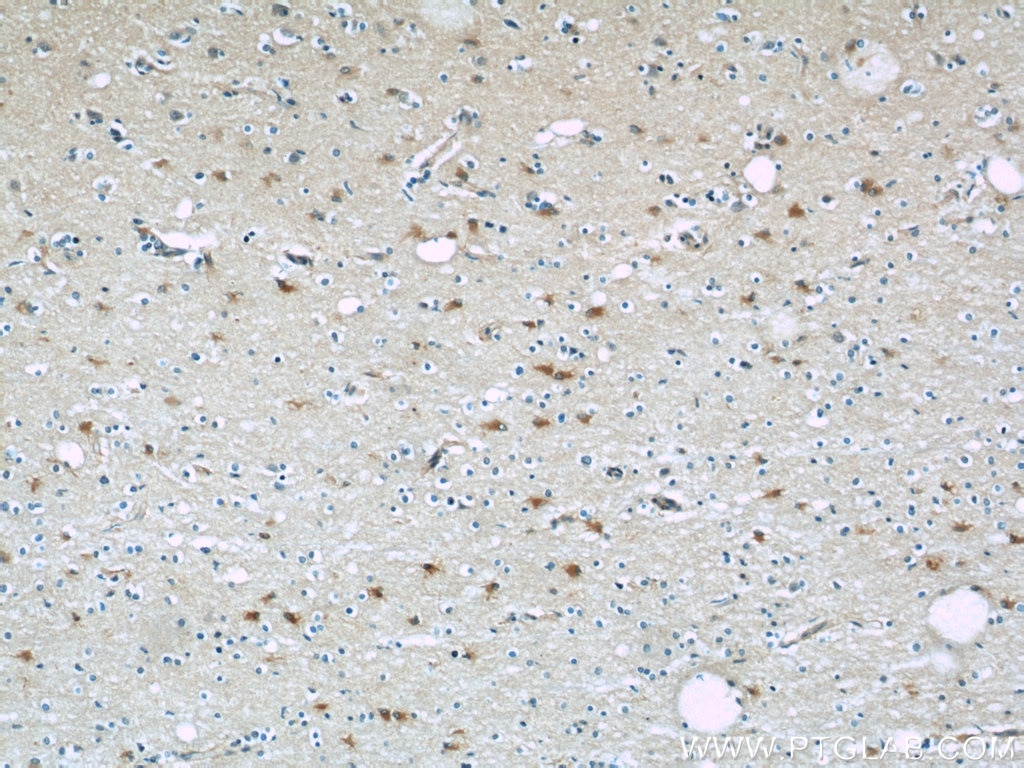 Immunohistochemistry (IHC) staining of human brain tissue using PGAM1 Polyclonal antibody (16126-1-AP)