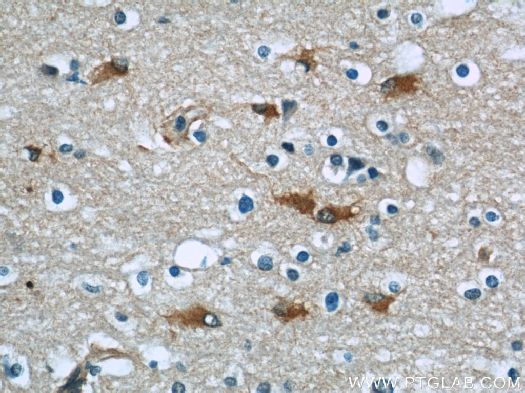 Immunohistochemistry (IHC) staining of human brain tissue using PGAM1 Polyclonal antibody (16126-1-AP)