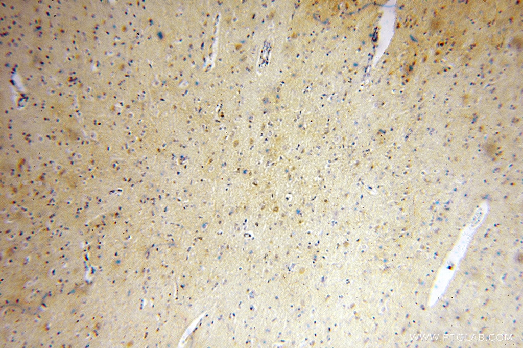 Immunohistochemistry (IHC) staining of human brain tissue using PGAM1 Polyclonal antibody (16126-1-AP)