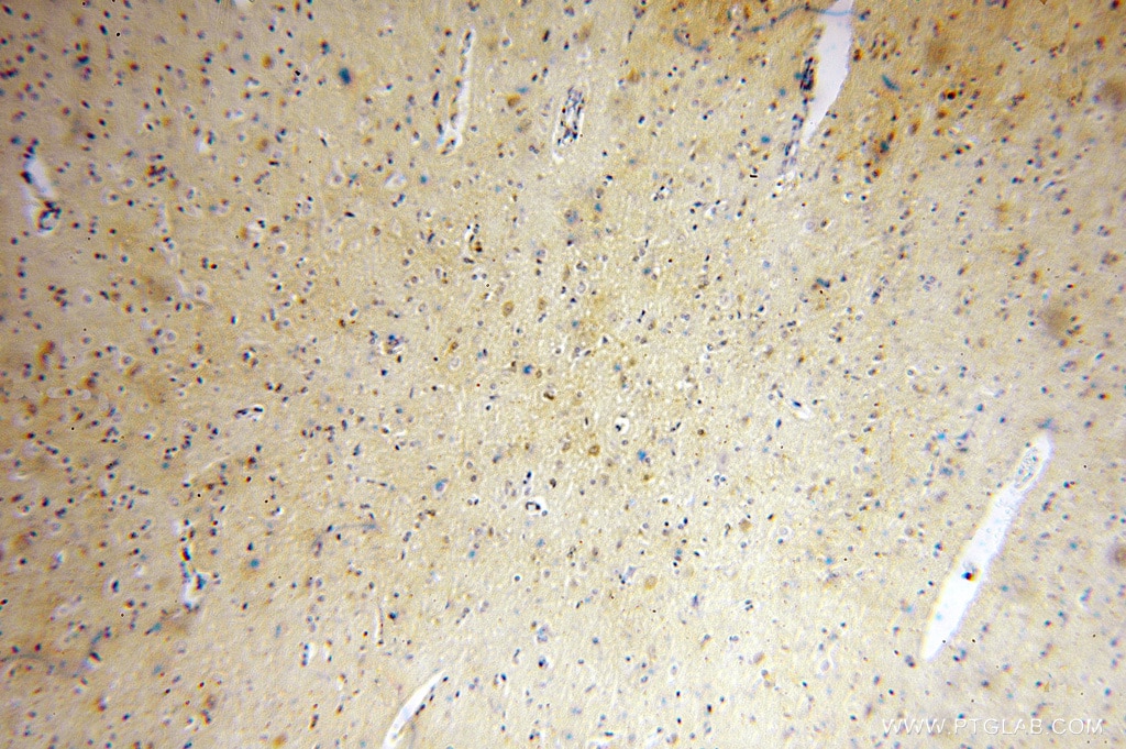 IHC staining of human brain using 16126-1-AP