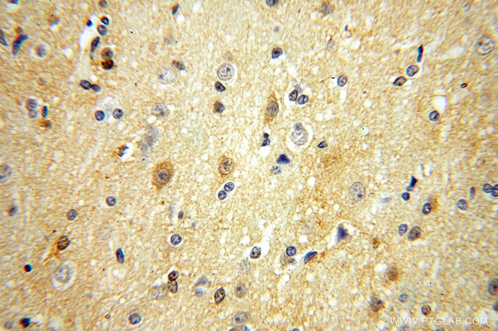 Immunohistochemistry (IHC) staining of human brain tissue using PGAM1 Polyclonal antibody (16126-1-AP)