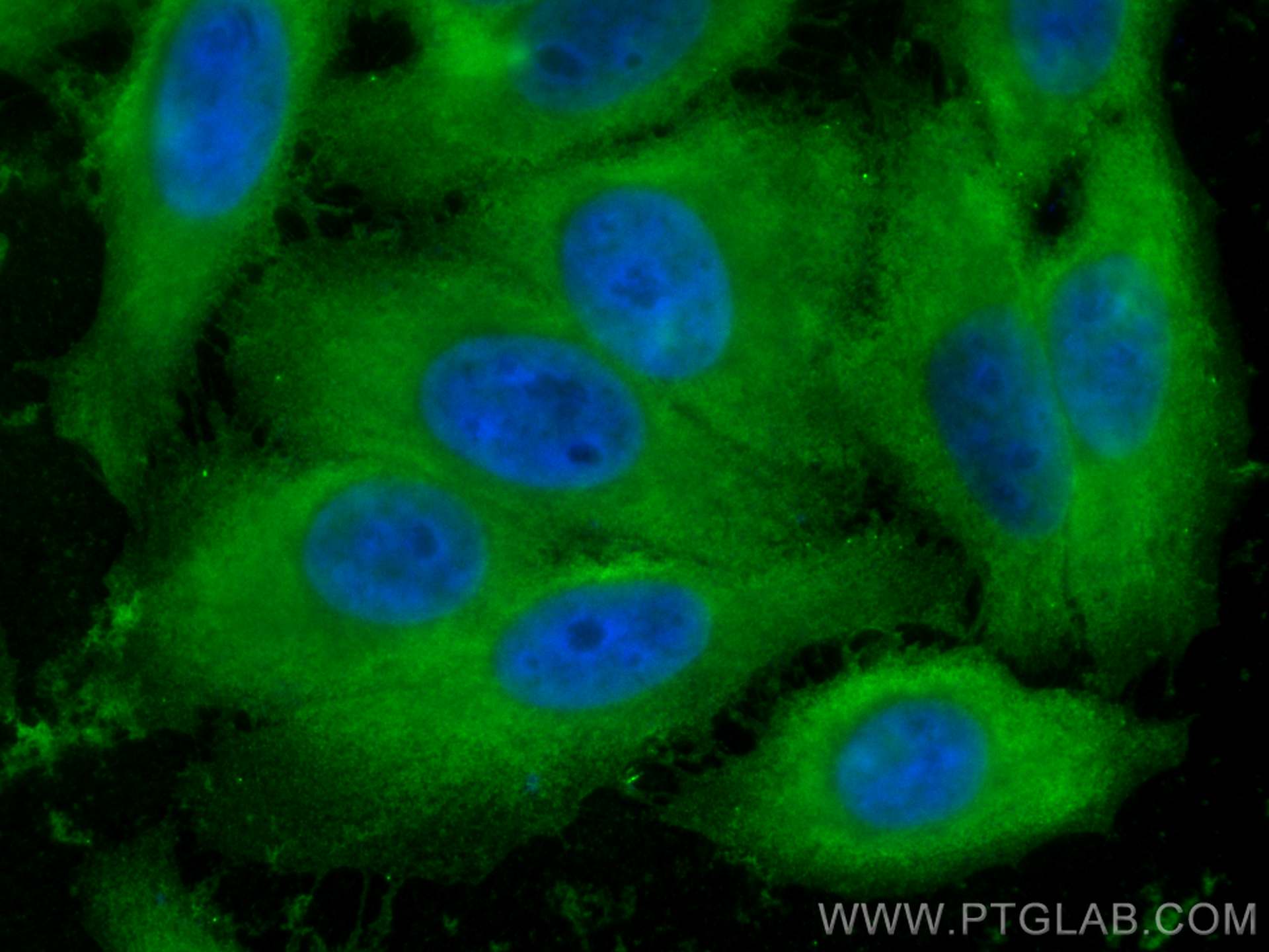 Immunofluorescence (IF) / fluorescent staining of HepG2 cells using PGAM1 Monoclonal antibody (67470-1-Ig)