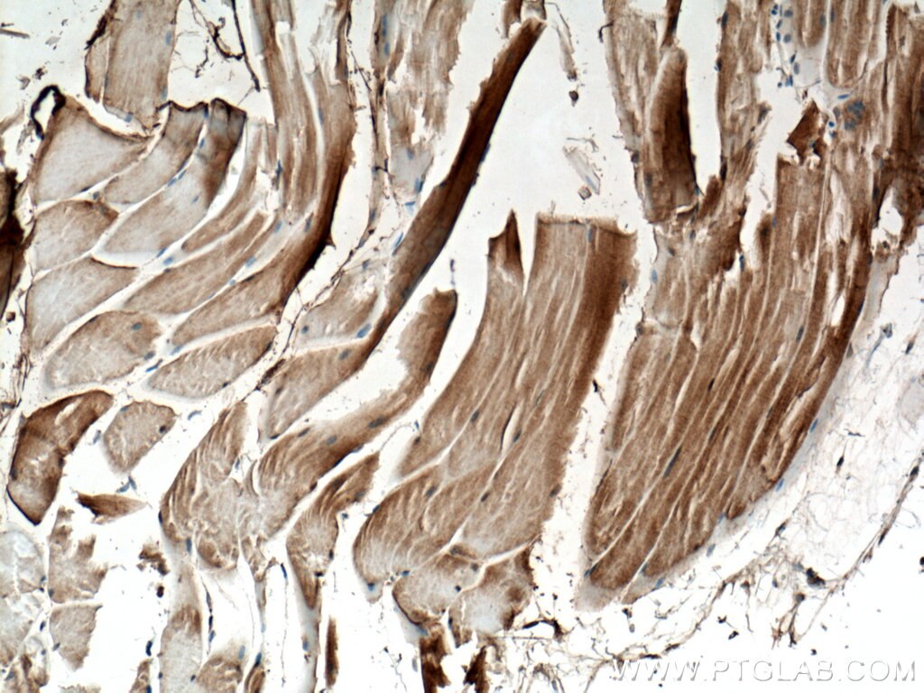Immunohistochemistry (IHC) staining of mouse skeletal muscle tissue using PGAM2 Polyclonal antibody (15550-1-AP)