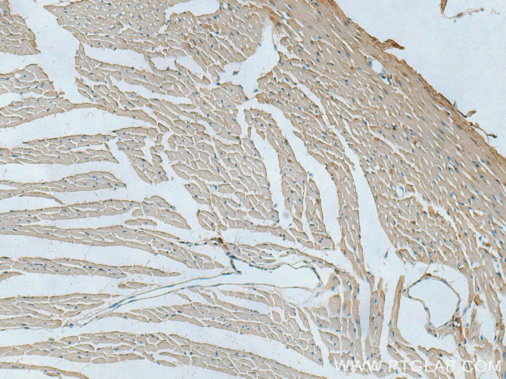 Immunohistochemistry (IHC) staining of mouse heart tissue using PGAM2 Polyclonal antibody (15550-1-AP)