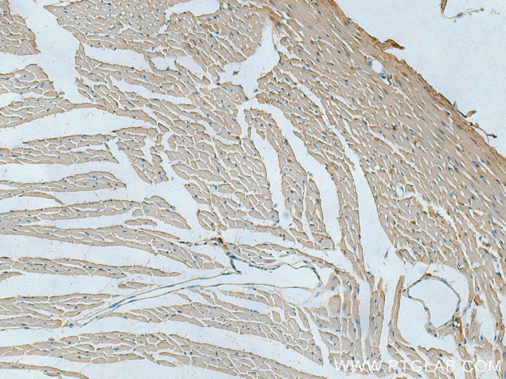 IHC staining of mouse heart using 15550-1-AP