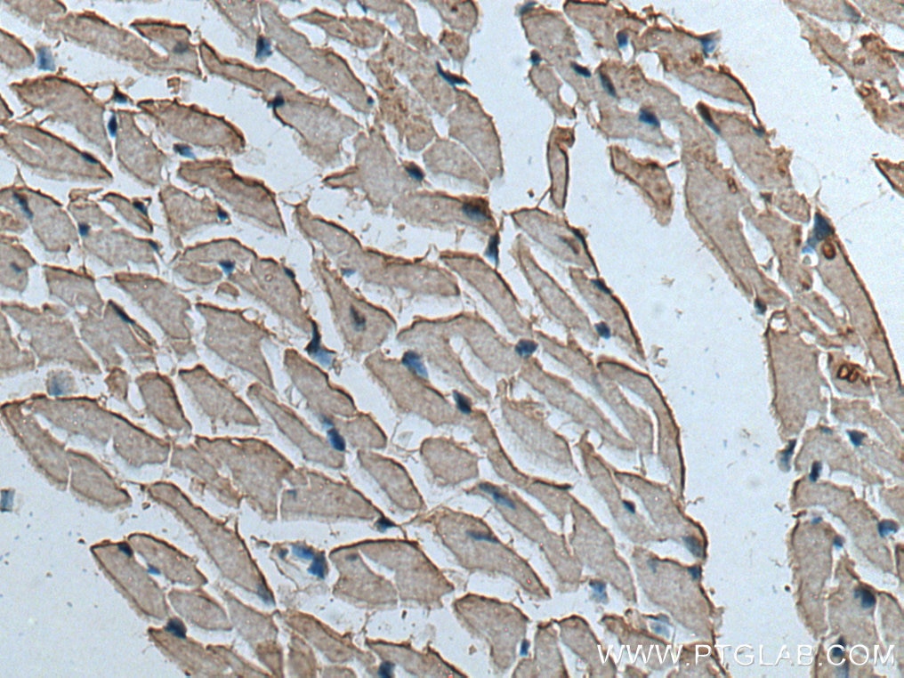 Immunohistochemistry (IHC) staining of mouse heart tissue using PGAM2 Polyclonal antibody (15550-1-AP)