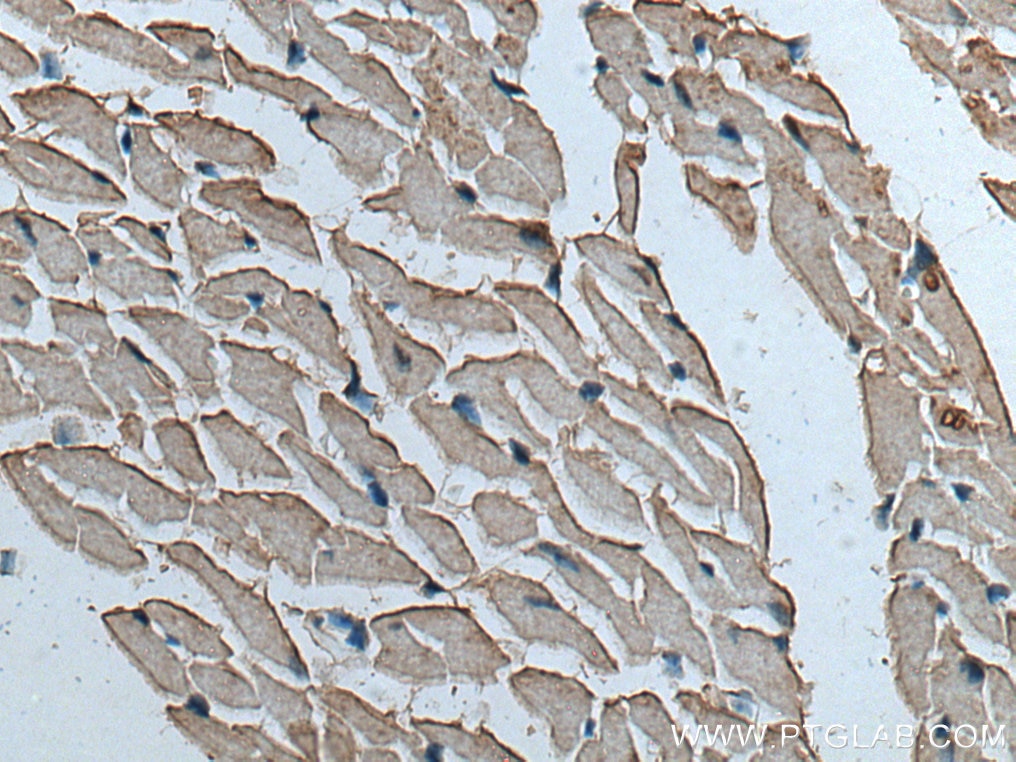 IHC staining of mouse heart using 15550-1-AP